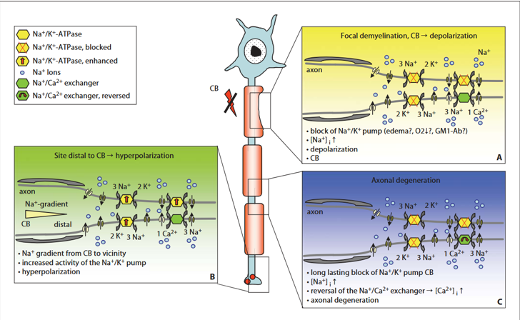Pathophysiology