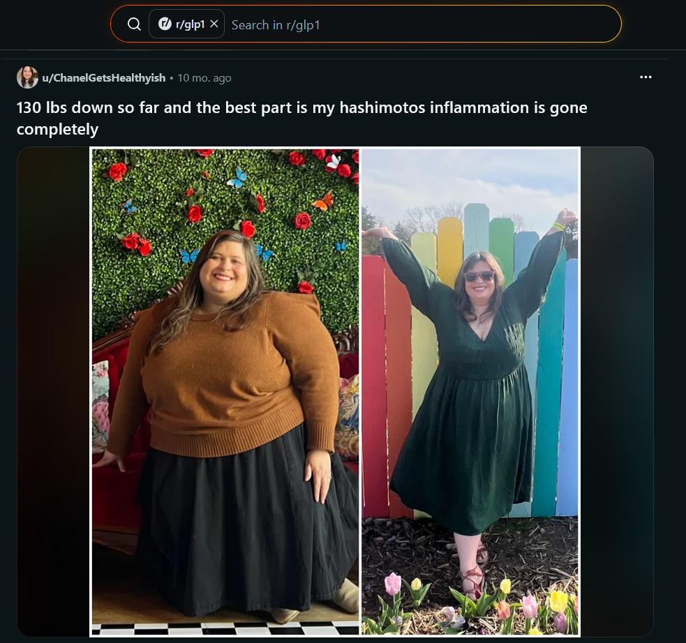 Reddit r/glp1 discussion